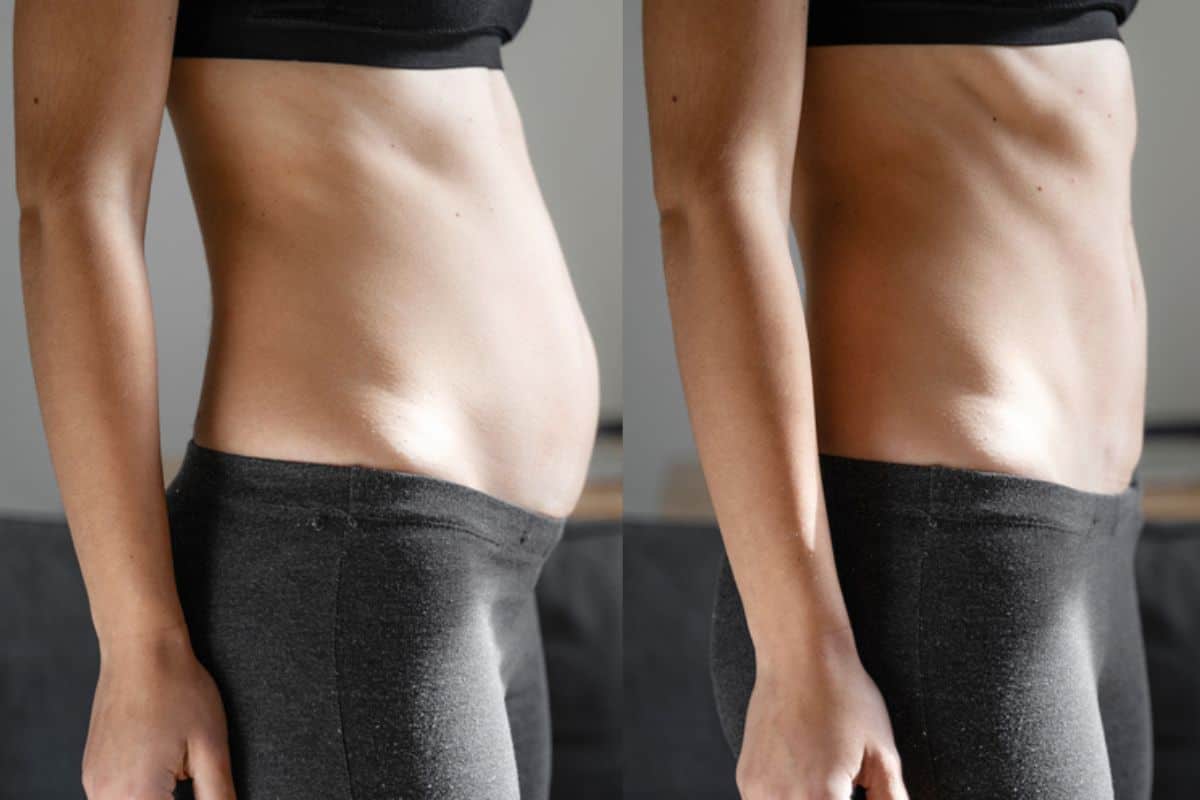 Post-Pregnancy: What Happens to Your Abdominal Muscles After Birth Norbiton