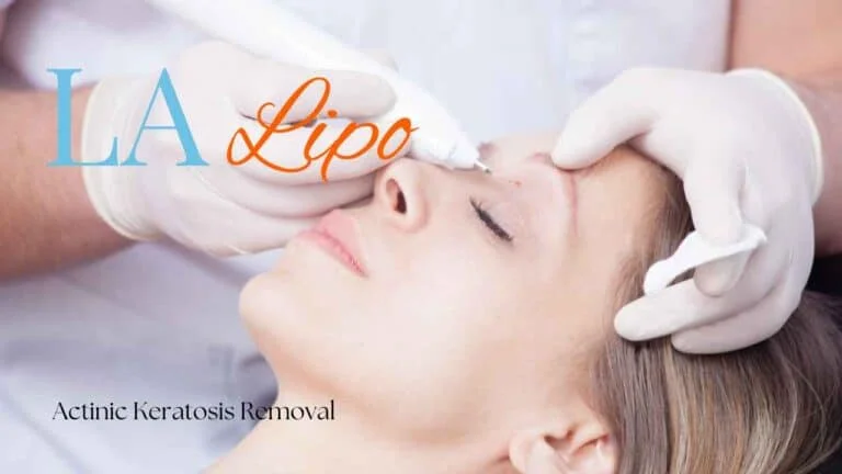 Woman receiving Actinic Keratosis Removal Treatment Norbiton