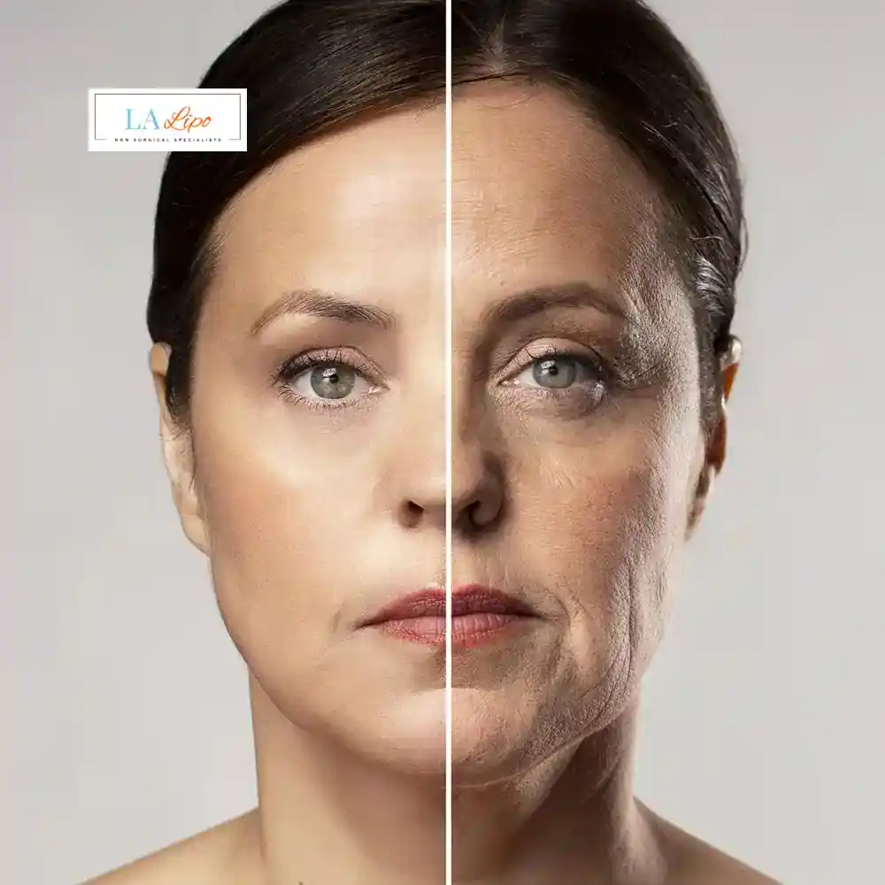 How Can You Tell If Non-Surgical Skin Tightening Is Right for You Norbiton?