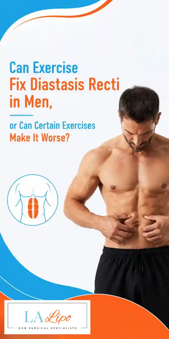 Can Exercise Fix Diastasis Recti in Men, or Can Certain Exercises Make It Worse Norbiton?